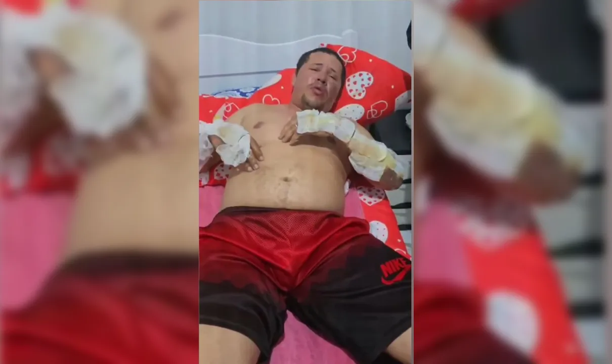 Motorista de app queimado em incêndio forjou sequestro para fraudar seguro veicular, diz PCAL