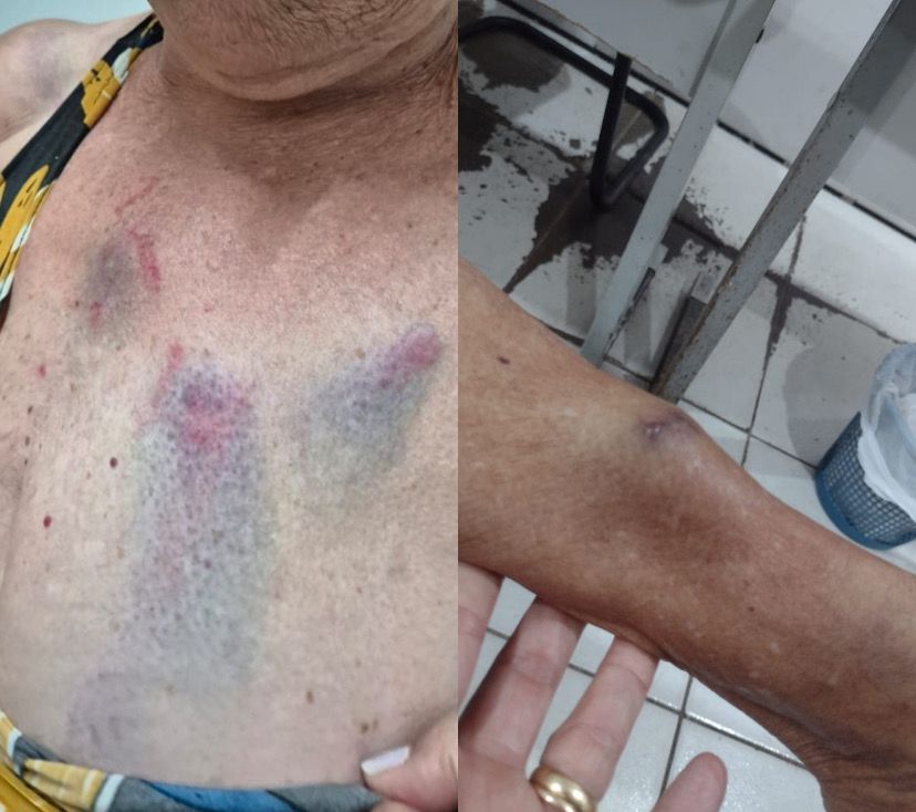 Médica é presa duas vezes por agredir tia de 77 anos em Arapiraca;briga teria começado por senha de Wi-Fi