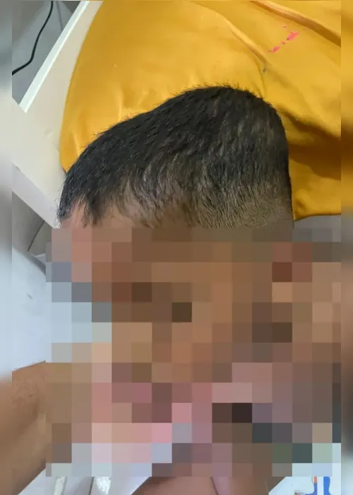 Vídeo e relatos levam família a denunciar agressões contra criança com autismo em Arapiraca; veja