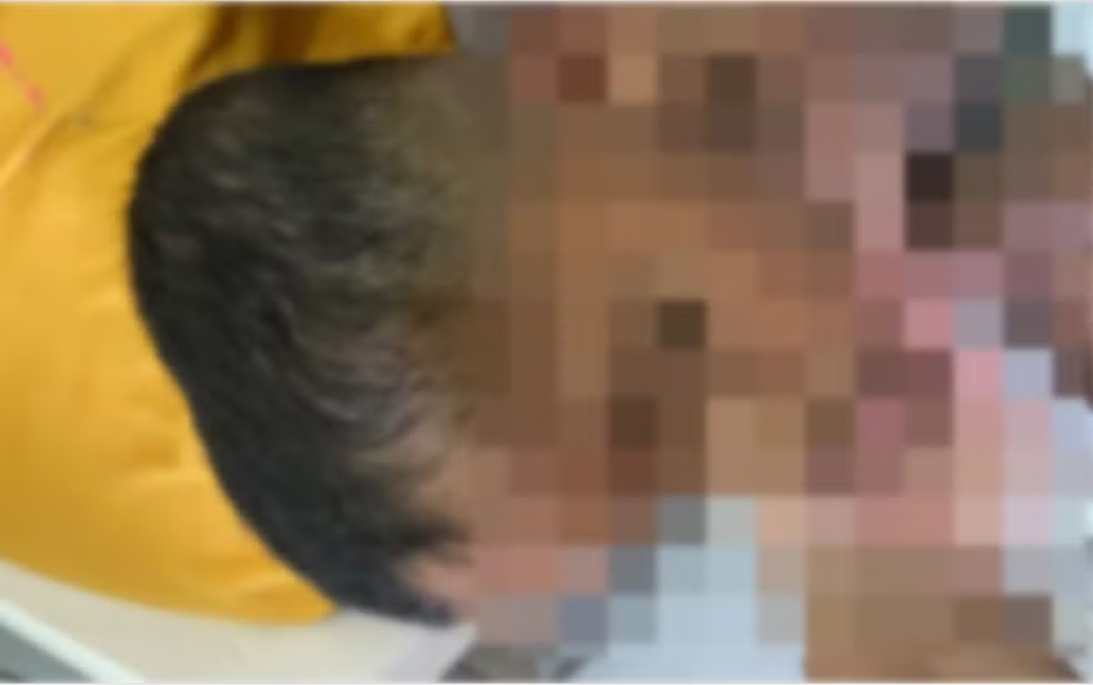 MP investiga babá suspeita de agredir criança autista não verbal em Arapiraca