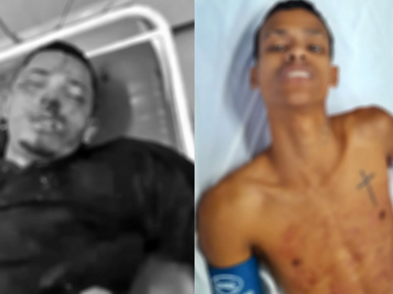 Guarda Municipal reage a tentativa de homicídio e dois suspeitos ficam feridos em São Miguel dos Campos