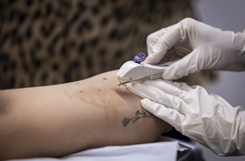 Secretaria de Saúde de Maceió já ofereceu implante contraceptivo gratuito a quase 700 mulheres em dois meses