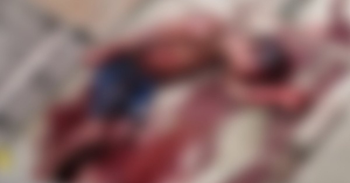 Homem é espancado por populares após suspeita de roubo no Feitosa, em Maceió