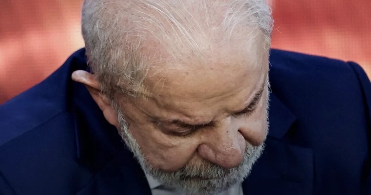 Lula vai a hospital após retirada de lesão na cabeça e apresenta “evolução satisfatória “