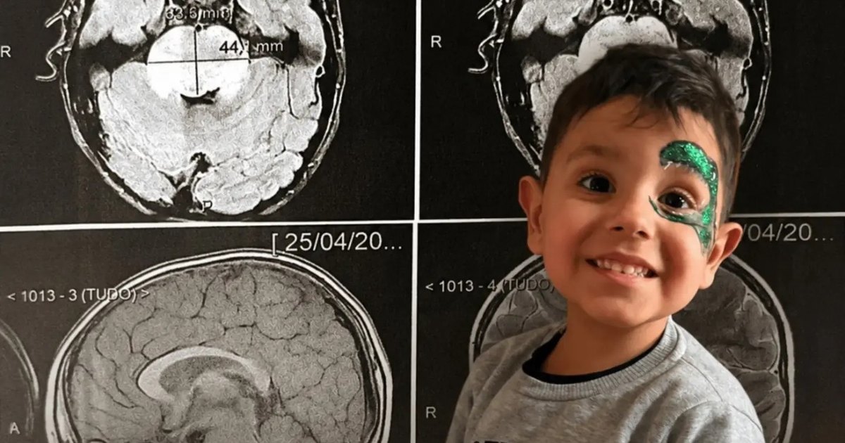 Após diagnóstico devastador, família luta para garantir qualidade de vida a menino com tumor raro no cérebro