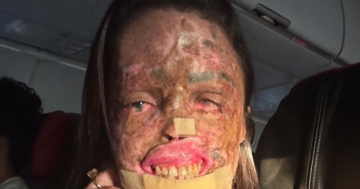 Influenciadora Karine Felipe morre aos 36 anos após batalha contra doença rara