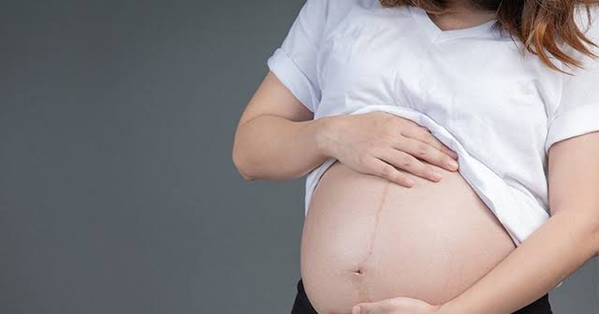 Cesariana pode aumentar em 45% risco de câncer raro ligado à placenta