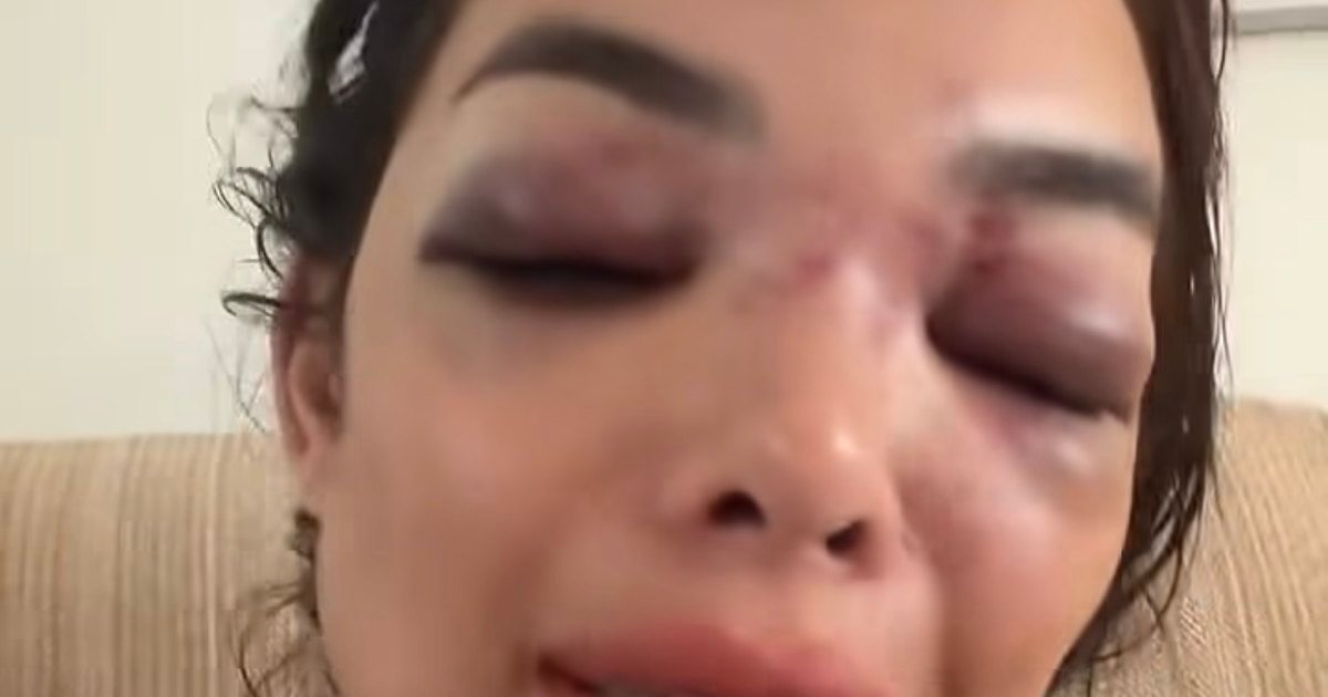 Empresário da Faria Lima é preso por agredir mulher com taco de beisebol em SP