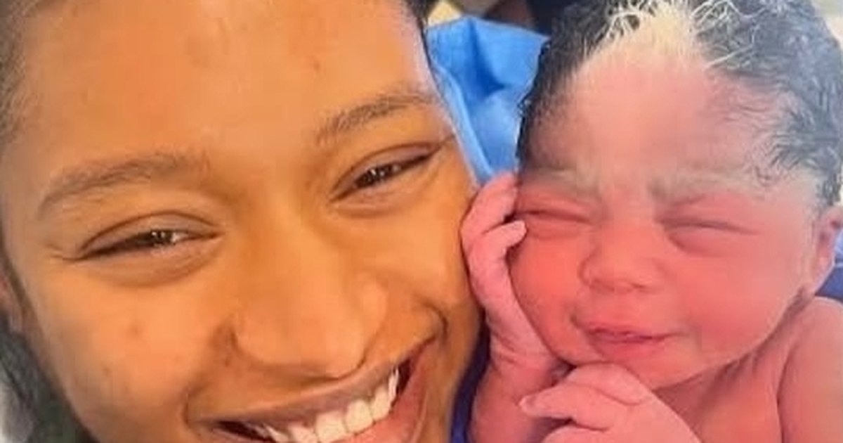 Bebê nasce com a mesma mecha branca da mãe e semelhança surpreende nas redes sociais