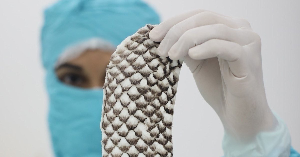 Brasil terá primeira fábrica do mundo de pele de tilápia para tratar queimaduras; entenda