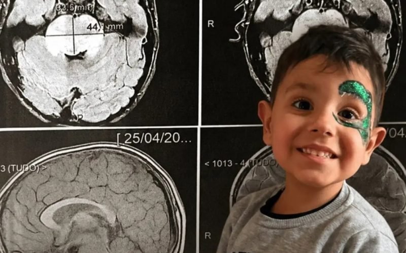 Após diagnóstico devastador, família luta para garantir qualidade de vida a menino com tumor raro no cérebro
