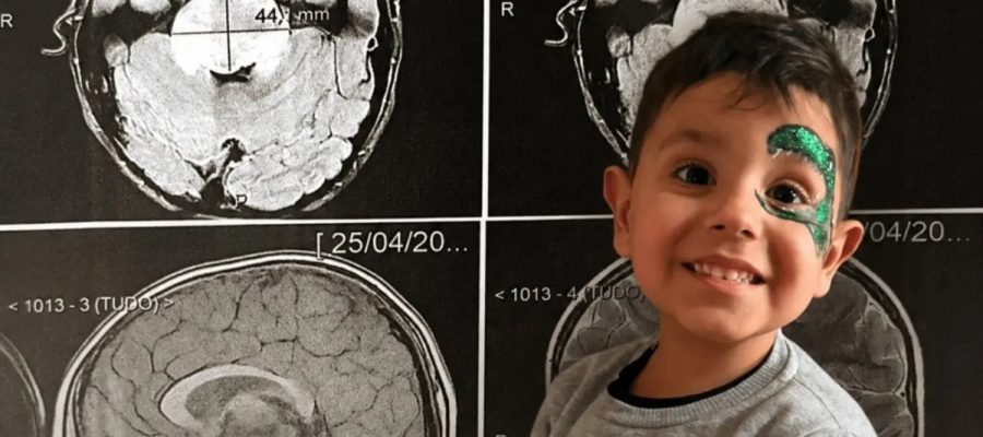 Após diagnóstico devastador, família luta para garantir qualidade de vida a menino com tumor raro no cérebro
