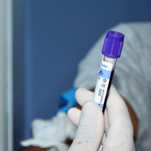 Hemoal realiza cadastro para doação de medula óssea em Maceió nessa sexta (27)