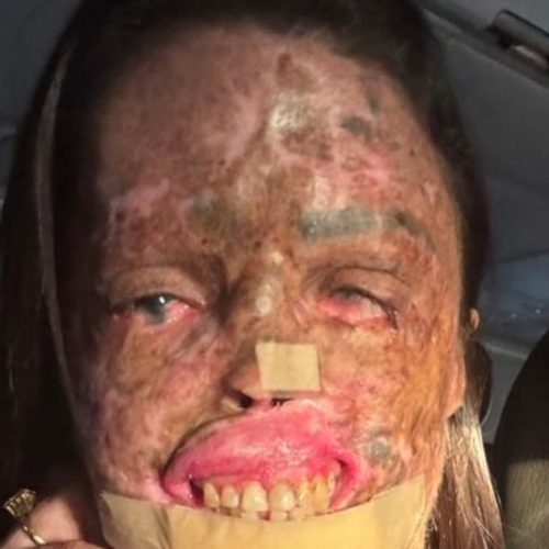 Influenciadora Karine Felipe morre aos 36 anos após batalha contra doença rara