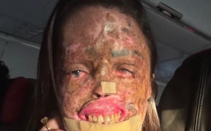 Influenciadora Karine Felipe morre aos 36 anos após batalha contra doença rara