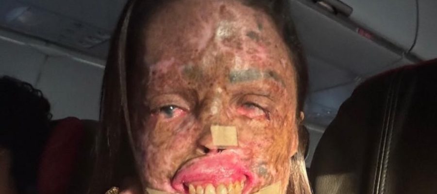Influenciadora Karine Felipe morre aos 36 anos após batalha contra doença rara