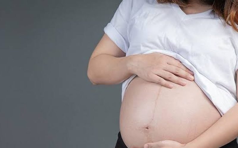 Cesariana pode aumentar em 45% risco de câncer raro ligado à placenta