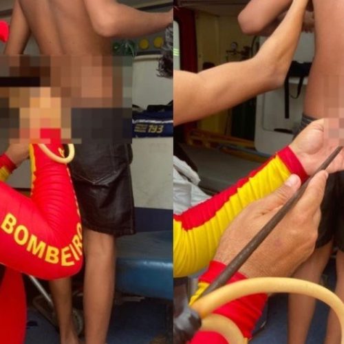 Adolescente é atingido por arpão durante pesca subaquática na Praia do Francês