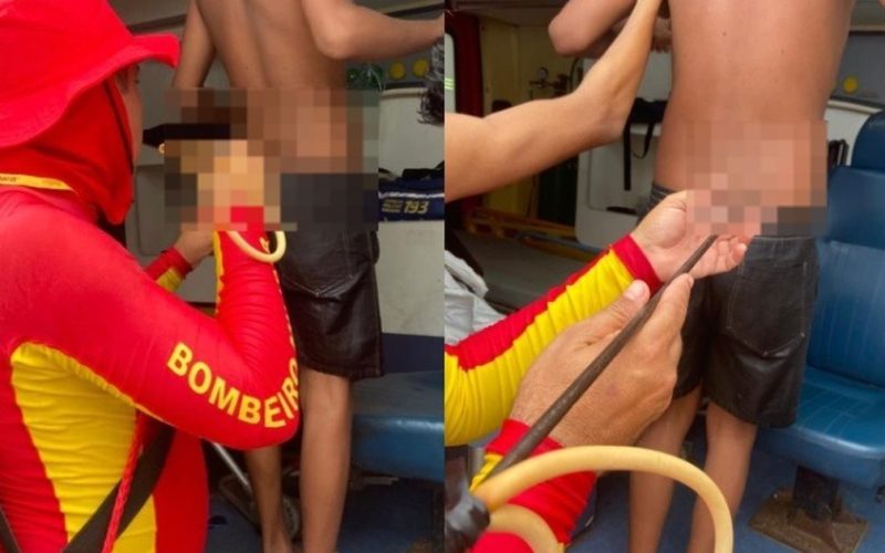 Adolescente é atingido por arpão durante pesca subaquática na Praia do Francês