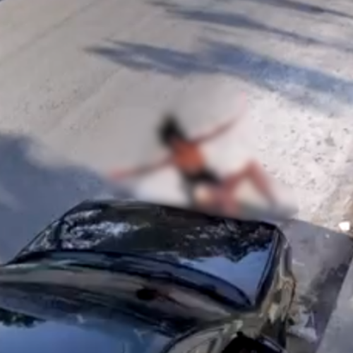 Mulher que foi atropelada e arrastada sai do coma após 4ª cirurgia