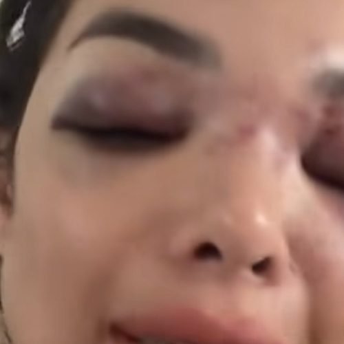 Empresário da Faria Lima é preso por agredir mulher com taco de beisebol em SP