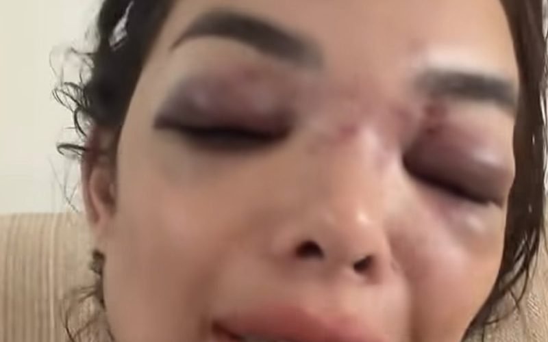 Empresário da Faria Lima é preso por agredir mulher com taco de beisebol em SP