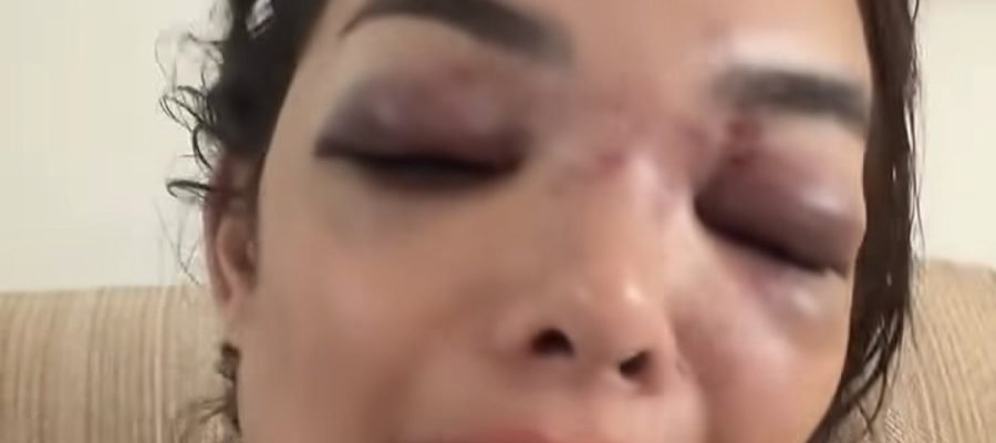Empresário da Faria Lima é preso por agredir mulher com taco de beisebol em SP