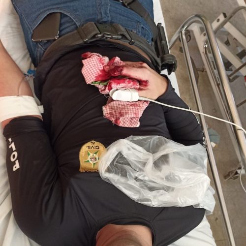 Policial Civil é atingido em operação em Senador Rui Palmeira; suspeito é acusado de tramar a morte do próprio pai
