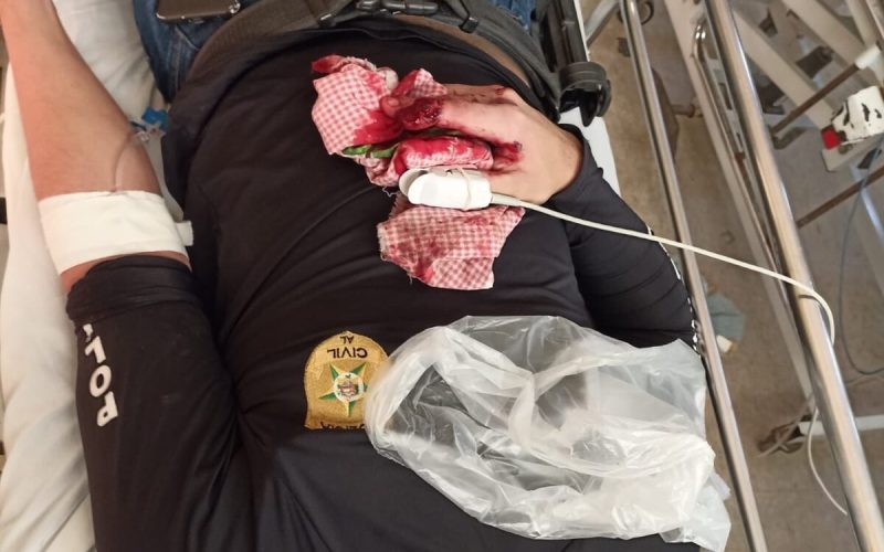 Policial Civil é atingido em operação em Senador Rui Palmeira; suspeito é acusado de tramar a morte do próprio pai