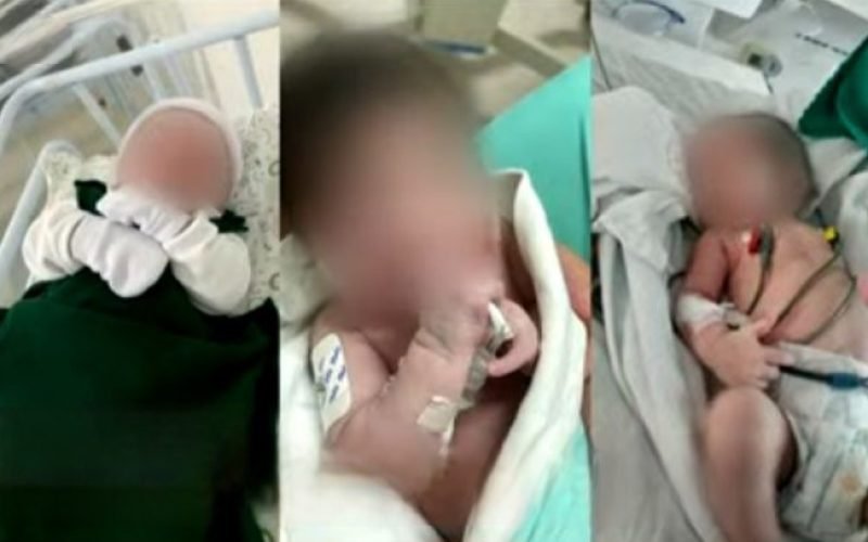 Mães denunciam Governo de Alagoas por não cumprir decisão da Defensoria Pública e atrasar cirurgias de três bebês