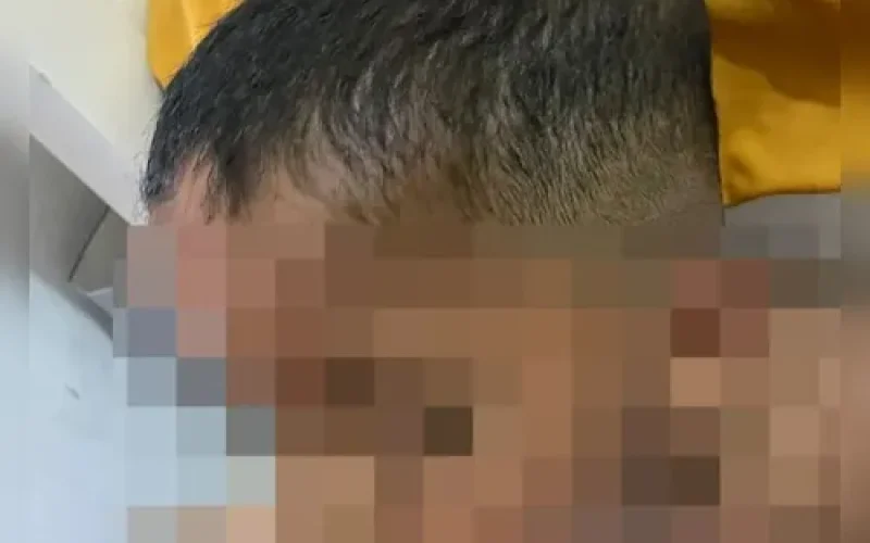 Vídeo e relatos levam família a denunciar agressões contra criança com autismo em Arapiraca; veja