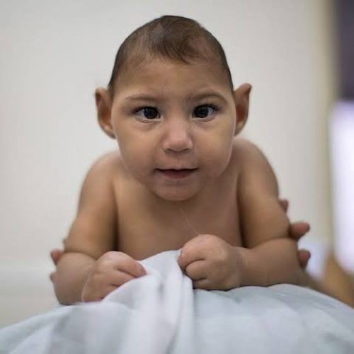 Câmara aprova pensão vitalícia de R$7 mil para vítimas de microcefalia causada pelo Zika vírus