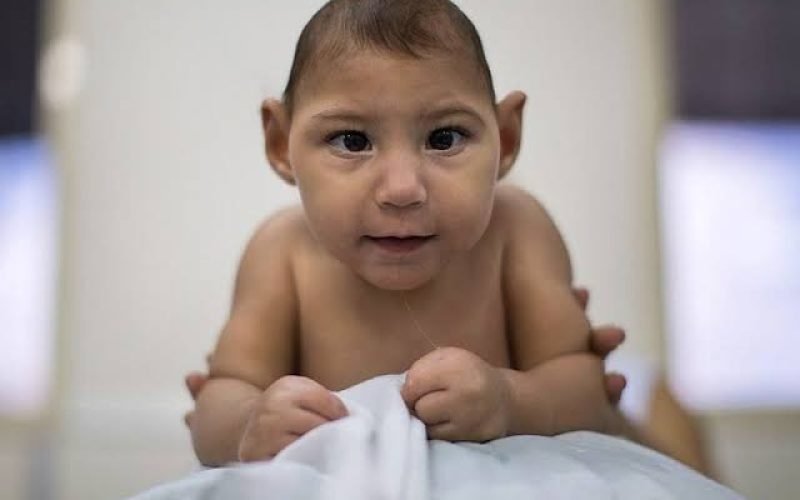 Câmara aprova pensão vitalícia de R$7 mil para vítimas de microcefalia causada pelo Zika vírus