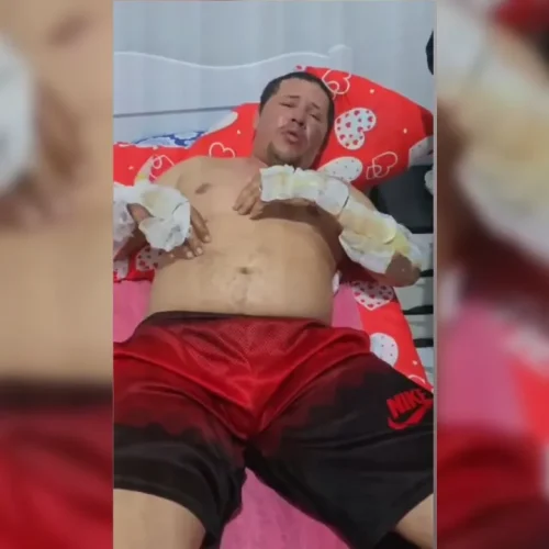 Motorista de app queimado em incêndio forjou sequestro para fraudar seguro veicular, diz PCAL