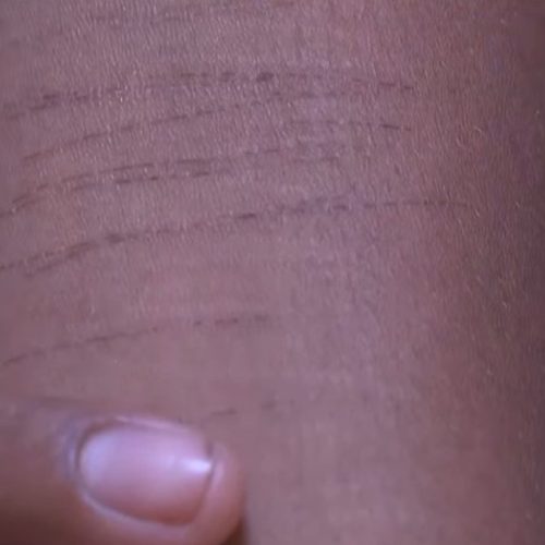 “Um vinha, outro saía, outro vinha, saía”, relata vítima de estupro coletivo em Rio Largo