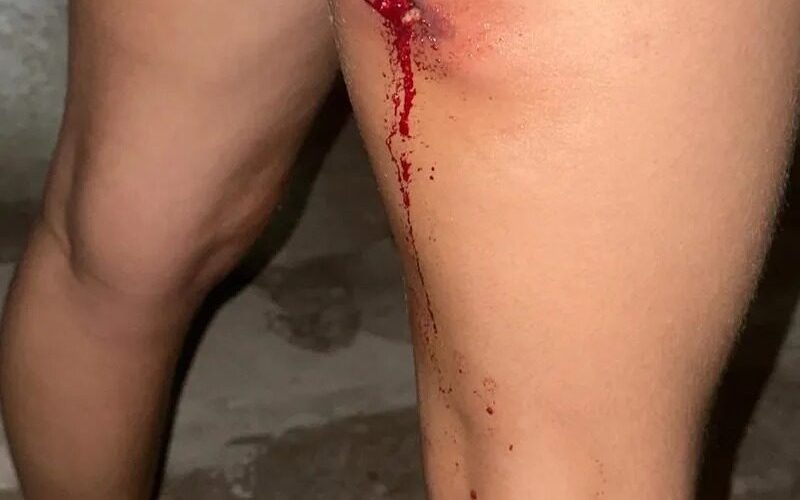 Torcedora denuncia ferimento por bala de borracha em confusão no Rei Pelé