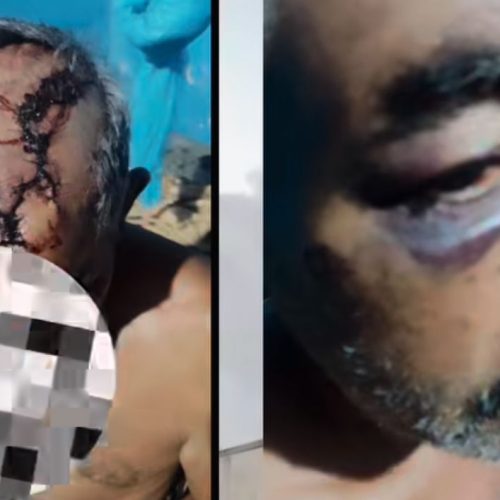 Polícia prende autores de tentativa de latrocínio contra idoso em Coruripe; vítima se fingiu de morta para escapar