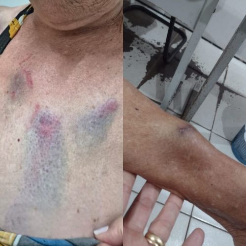 Médica é presa duas vezes por agredir tia de 77 anos em Arapiraca;briga teria começado por senha de Wi-Fi