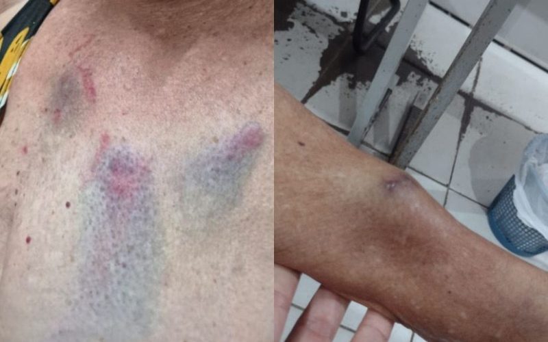 Médica é presa duas vezes por agredir tia de 77 anos em Arapiraca;briga teria começado por senha de Wi-Fi