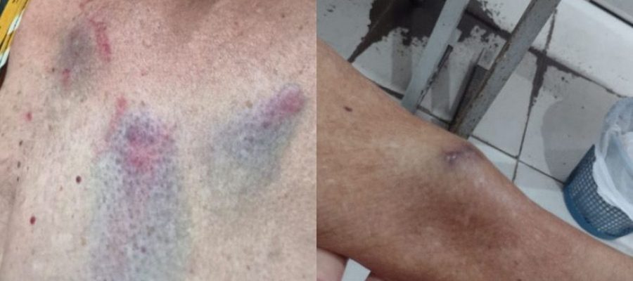 Médica é presa duas vezes por agredir tia de 77 anos em Arapiraca;briga teria começado por senha de Wi-Fi