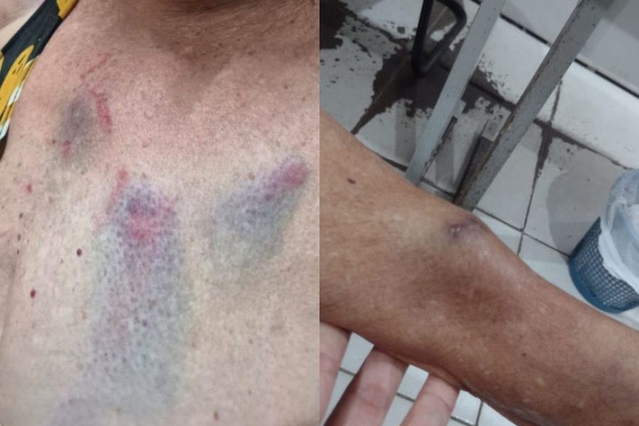Médica é presa duas vezes por agredir tia de 77 anos em Arapiraca;briga teria começado por senha de Wi-Fi
