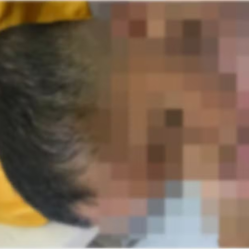 MP investiga babá suspeita de agredir criança autista não verbal em Arapiraca