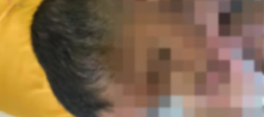 MP investiga babá suspeita de agredir criança autista não verbal em Arapiraca