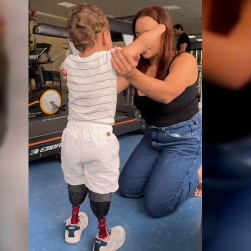 Bebê alagoano recebe próteses e volta a andar após pai perder R$ 113 mil com jogos de azar