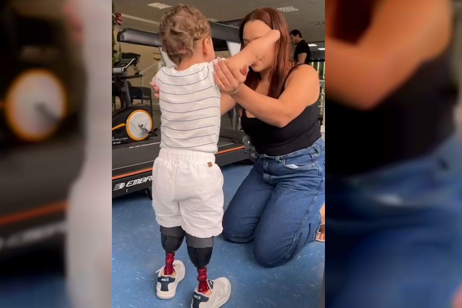 Bebê alagoano recebe próteses e volta a andar após pai perder R$ 113 mil com jogos de azar