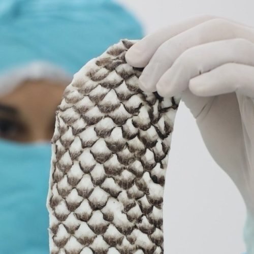 Brasil terá primeira fábrica do mundo de pele de tilápia para tratar queimaduras; entenda