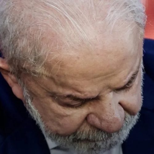 Lula vai a hospital após retirada de lesão na cabeça e apresenta “evolução satisfatória “