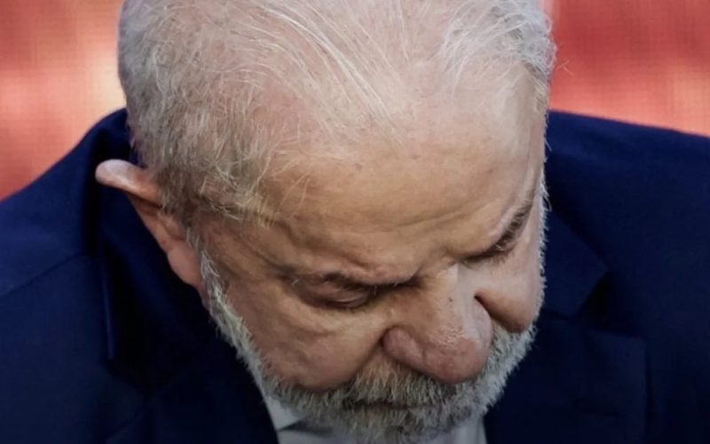 Lula vai a hospital após retirada de lesão na cabeça e apresenta “evolução satisfatória “