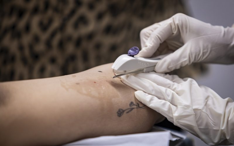 Secretaria de Saúde de Maceió já ofereceu implante contraceptivo gratuito a quase 700 mulheres em dois meses