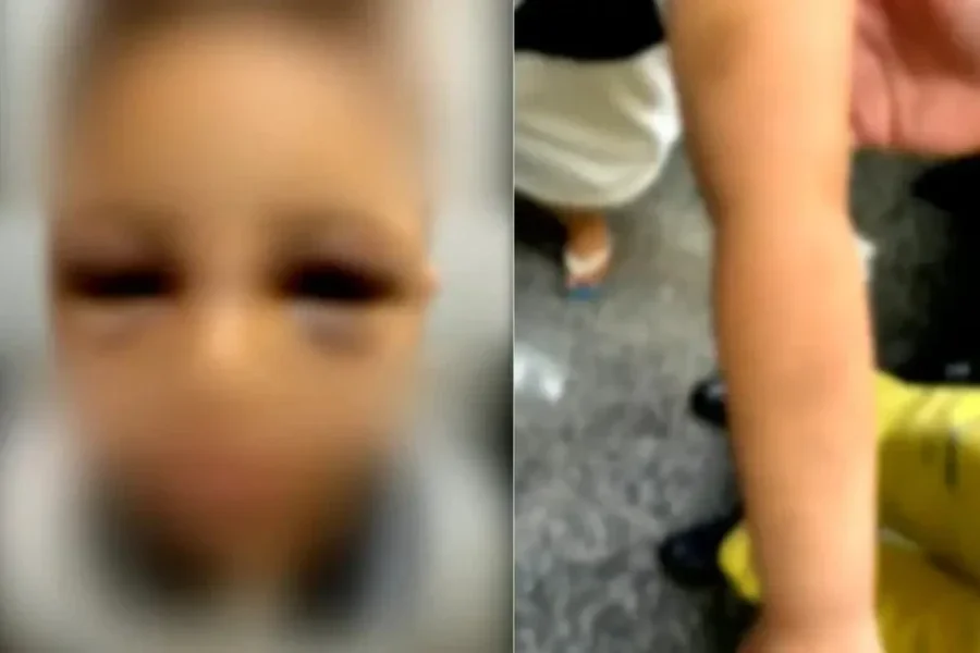 “Para não virar bandido”, pai é preso após espancar filho autista e tentar justificar agressões